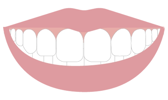 見える歯の本数