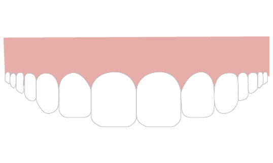 歯ぐきの厚み・位置