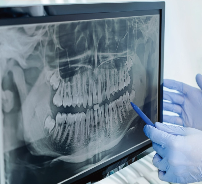 診断・治療計画のご提案