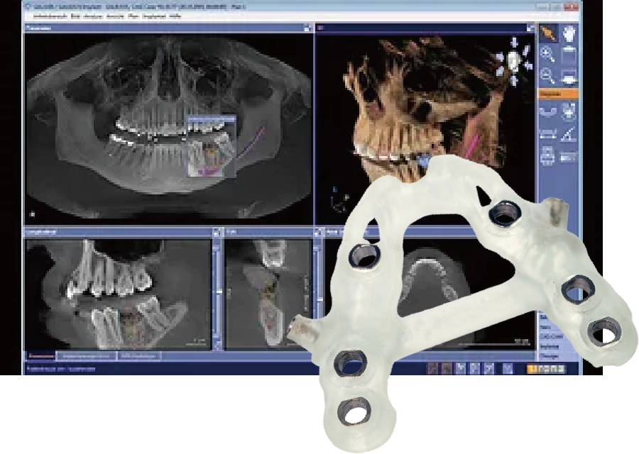 シミュレーションソフトSICAT