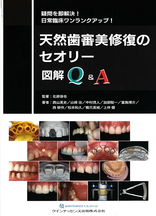 天然歯審美修復のセオリー図解Q＆A