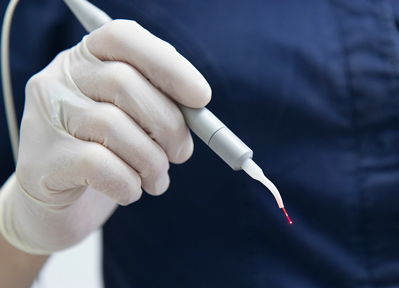 レーザーを活用した治療